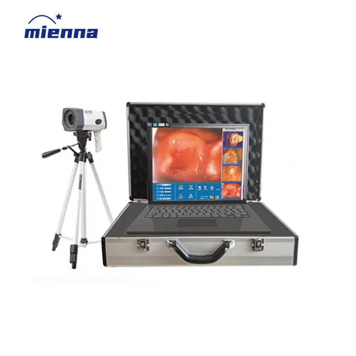 Colposcopio Elettronico Digitale per Ginecologia Chirurgica